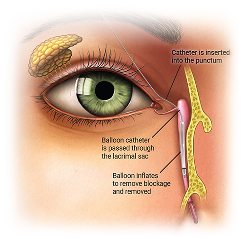 Patient Information - :: Quest Medical